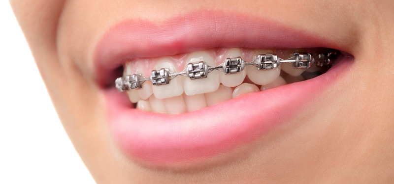 Orthodontics