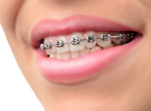 Orthodontics